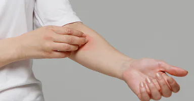 Bei Überempfindlichkeit gegen Zutaten Einnahme stoppen